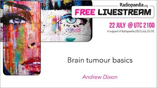 Brain tumour basics  Andrew Dixon Featured Video [upl. by Capriola]