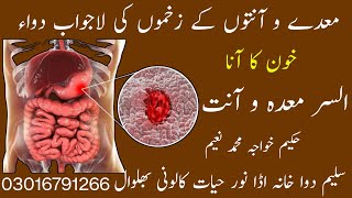 Gastric and Duodenal Ulcer Stomach Ulcerمعدے و آنت کے السر کا علاج [upl. by Siesser]