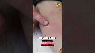 🔴 Bullet Ant Sting Challenge Extreme Pain amp Relief Tested 🔴 PainChallenge BulletAnt shorts [upl. by Annie928]