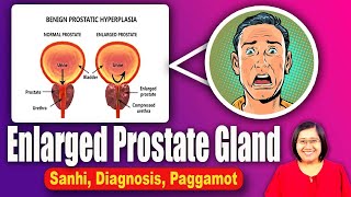 Enlarged Prostate Signs Symptoms Causes Treatments Mens Health  Tagalog Health  Nurse Dianne [upl. by Melgar]