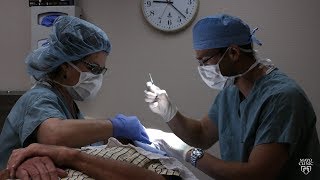 Mayo Clinic Minute How Mohs surgery is used to fight skin cancer [upl. by Novyak781]