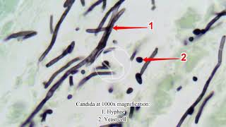 Candida under the microscope with Gomoris Methenamine Silver GMS stain [upl. by Sorips326]