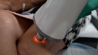 USF Health and Tampa VA announce revolutionary skin cancer detection technology [upl. by Dareece230]