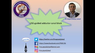 USG Guided Adductor canal block [upl. by Ahsiekan]