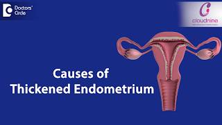 What causes Endometrial thickness  DrSmitha Sha of Cloudnine Hospitals  Doctors Circle [upl. by Ffoeg]