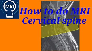 How to do MRI Cervical Spine MRI Cervical Spine Planing and position Cervical spine MRI [upl. by Nivek]