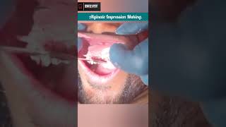 Alginate Impression Making for Crown amp FPD Fabrication  Dental Impression shorts dentist viral [upl. by Siravat]