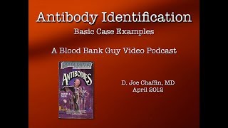 Antibody ID The Basics Part 1 [upl. by Demodena52]