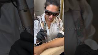 Pico Laser Treatment For Sun Tan Removal  Benefits Of Pico Laser Treatment [upl. by Ariuqahs]