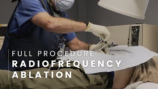 Radiofrequency Ablation Full Procedure  Lumbar [upl. by Yerok]