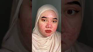 How to cover pimples in 1 foundation😱 supportmychannel youtubeshorts mekuptutorial viralvideos [upl. by Nivel]