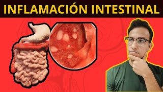 5 COSAS QUE TE INFLAMAN EL INTESTINO Síndrome de Intestino Irritable [upl. by Orodoet]