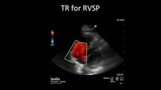 Principles of Doppler Ultrasound [upl. by Terpstra235]