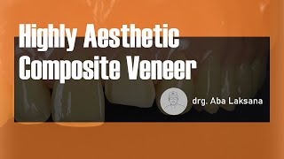 Direct Composite Veneer with 2 Layers Technique  Dental Aesthetic Restoration AMARIS® VOCO GmbH [upl. by Zacharias702]