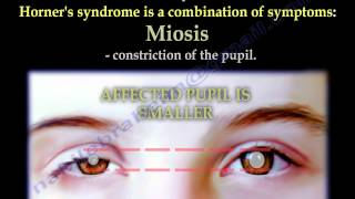 The Brachial Plexus amp Horners Syndrome  Everything You Need To Know  Dr Nabil Ebraheim [upl. by Nimaynib]