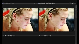 remove facial blemishes with photoshop [upl. by Feldstein]