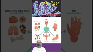 Candida Fungal Infection  Candidiasis  Urdu  Hindi  Shahbaz Qamar [upl. by Earlene]