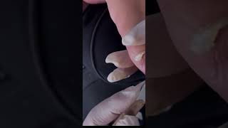 Cut long nail fyp podiatry ingrowntoenail Drming [upl. by Gosser]