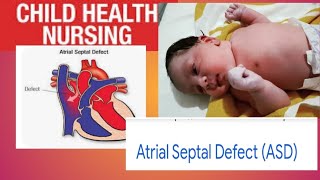 Atrial Septal Defect  Child Health Nursing 2nd class 2 with notes Congenital Heart disease [upl. by Kirrad]