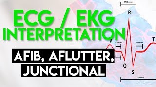 Afib Aflutter Junctional Arrhythmias  ECG EKG Interpretation Part 4 [upl. by Eniwtna]