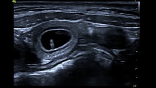 Canine foetal pole imaged on ScanPad and Vinno D6 [upl. by Heindrick]