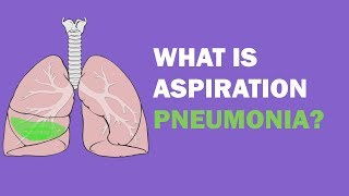 What is aspiration pneumonia [upl. by Mathian]