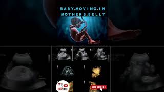 fetal growth baby moving in the womb baby movement during the pregnancy share video pregnancy [upl. by Austin]