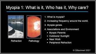 Myopia 1 What is it Who has it and Why care [upl. by Eelarac]