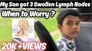 Lymph Nodes Behind Ear Swollen Lymph Nodes Behind Ear When to Worry Lump Behind Ear [upl. by Ahseenak]