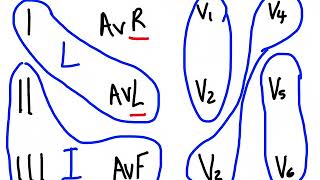 ECG Interpretation  ECG Made Easy  Coronary Artery  Location of MI  STEMI  NSTEMI [upl. by Nutsud915]