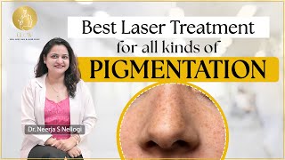 Laser treatment for pigmentation  Best Dermatologist in Mumbai  Dr Neerja S Nellogi [upl. by Aihcropal]