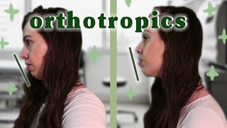 I Tried Orthotropics and Now I Dont Need Jaw Surgery  Mewing [upl. by Columbine712]