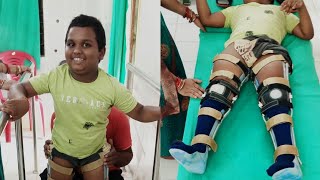 Cerebral Palsy Patients Was Stand With Support Of BL Knee Ankle Foot Orthosis [upl. by Sanoy986]