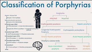 Classification of Porphyrias  What are Porphyrias and their classification [upl. by Airasor]