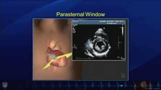 Echo Tutorial Comprehensive Transthoracic Echocardiogram  Mayo Clinic [upl. by Akiraa666]