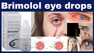 Brimolol eye drops uses in hindi  Timolol 5 mg  Brimonidine 15 mg benefits Side Effects [upl. by Ainimre]