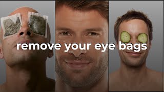 How To Remove EYE BAGS  BeYourBest BeYourBestOfficial​ [upl. by Warde]