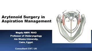 Arytenoid Surgery in Aspiration Management [upl. by Ennelram]