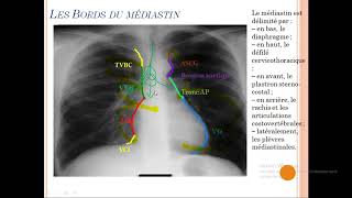 syndrome mediastinal 01 [upl. by Eiser]