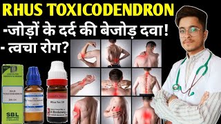 Rhus Tox 200 Homeopathic Medicine uses  Rhus Toxicodendron 30 uses in Hindi [upl. by Airamahs]