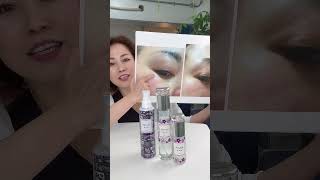 Restoring Youthful Eye Appearance with Natural Antioxidants [upl. by Fachini]