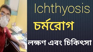 Ichthyosis চর্মরোগ কি [upl. by Lashoh]