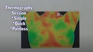 What Is Thermography Testing  What Do You Do And What Should You Expect [upl. by Otte]