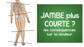 Jambe plus courte  les conséquences saisissantes sur la douleur [upl. by Katrinka833]