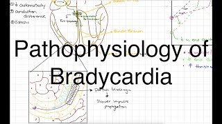 Pathophysiology of Bradycardia [upl. by Devaj]