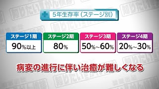 【知りたい！がん検診】Vol694回「子宮頸がん検診と治療法」 [upl. by Hazeghi]