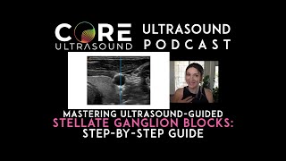 Mastering UltrasoundGuided Stellate Ganglion Blocks StepbyStep Guide [upl. by Annil669]