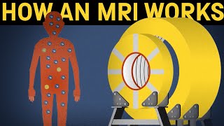 How does an MRI machine work [upl. by Ainotahs]