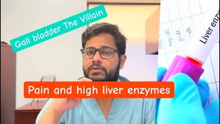 How Gallstones Cause Abdominal Pain and High Liver Enzymes [upl. by Ilagam]