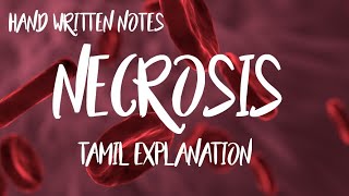 NECROSIS AND ITS TYPESTAMIL EXPLANATION HAND WRITTEN NOTES PATHOLOGY [upl. by Nellahs]